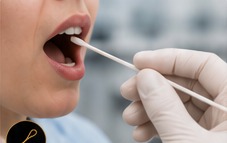 Hisopado bucal para prueba de ADN de paternidad